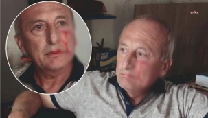 CHP’li Yarbaşı Belediye Başkanı Mustafa Kaynara saldırı!